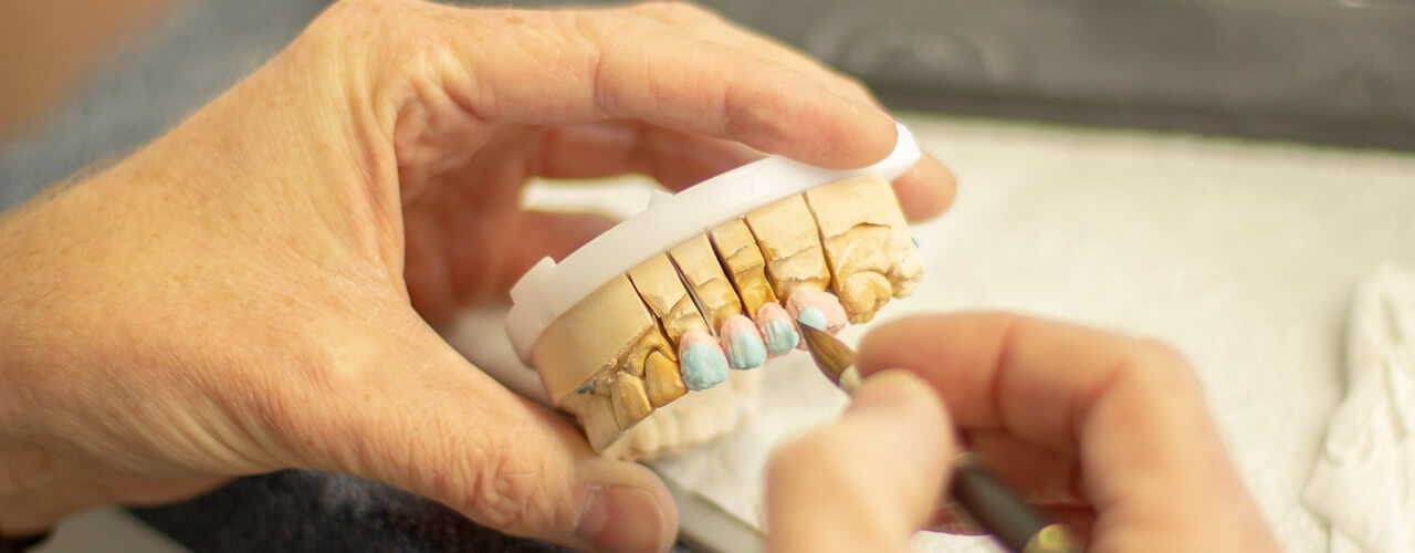Studio Dentistico Oriolo | Dott.ssa Carmen oriolo Odontoiatra Lido di Ostia | Protesi Fissa