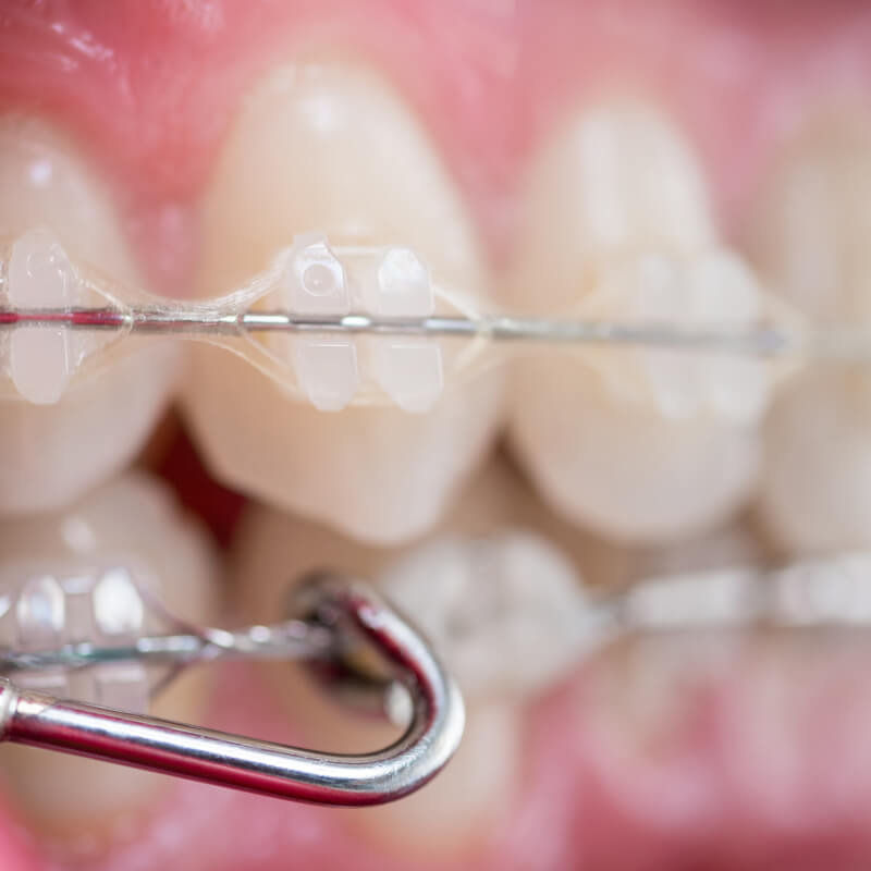 Studio Dentistico Oriolo | Ostia Lido | Denti Del Giudizio | Ortodonzia